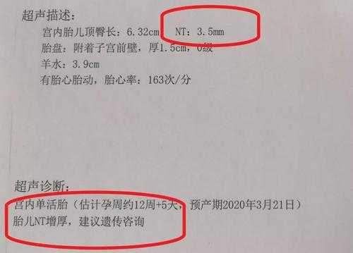 胎儿nf(有懂孕期NF增厚的大神吗) 第1张 胎儿nf(有懂孕期NF增厚的大神吗) 第1张