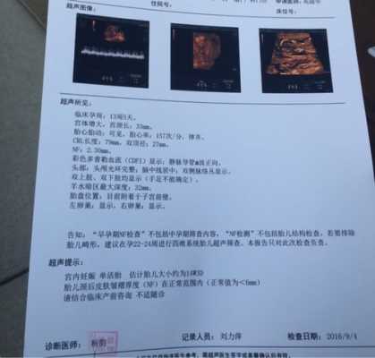 胎儿nf(有懂孕期NF增厚的大神吗) 第3张 胎儿nf(有懂孕期NF增厚的大神吗) 第3张