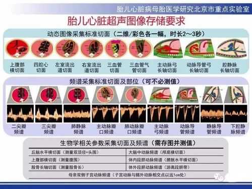 胎儿系统检查(胎儿系统检查了主要查什么) 第1张 胎儿系统检查(胎儿系统检查了主要查什么) 第1张