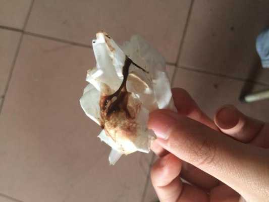 孕期分泌物有异味(孕期分泌物有异味但不痒) 第2张 孕期分泌物有异味(孕期分泌物有异味但不痒) 第2张