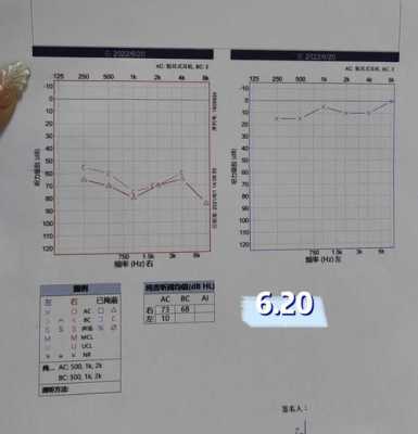 胎儿耳聋(胎儿耳朵聋能不能检查出来) 第2张 胎儿耳聋(胎儿耳朵聋能不能检查出来) 第2张