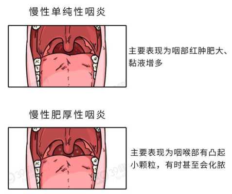 孕期喉咙有痰怎么办(孕期喉咙有痰怎么办又咳不出来咽) 第3张 孕期喉咙有痰怎么办(孕期喉咙有痰怎么办又咳不出来咽) 第3张