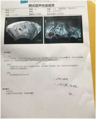 胎儿胎心快(胎儿胎心快是什么原因造成的啊?孕八个月多了,要做什么检查好) 第2张 胎儿胎心快(胎儿胎心快是什么原因造成的啊?孕八个月多了,要做什么检查好) 第2张