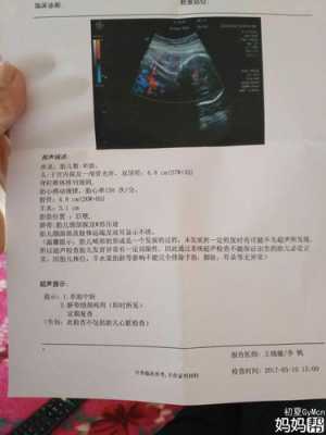 胎儿彩超多少钱(普通彩超能查出胎儿畸形吗) 第2张 胎儿彩超多少钱(普通彩超能查出胎儿畸形吗) 第2张
