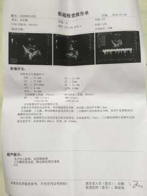 胎儿心脏有问题(胎儿心脏有问题是什么原因造成的) 第2张 胎儿心脏有问题(胎儿心脏有问题是什么原因造成的) 第2张