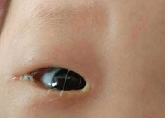 宝宝哭有时没眼泪?新生儿会有眼泪吗,6个月的胎儿会哭吗 第1张 宝宝哭有时没眼泪?新生儿会有眼泪吗,6个月的胎儿会哭吗 第1张