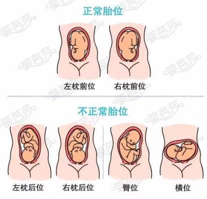 胎位正常胎儿在哪里动,胎儿胎位图解  第2张