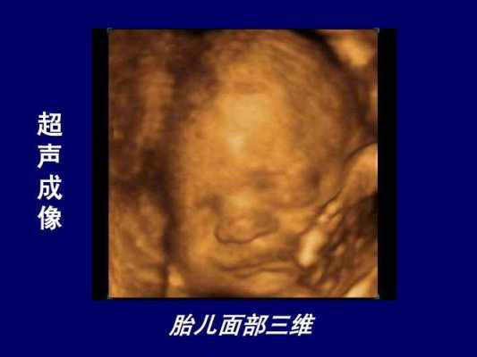 什么是三维,三维胎儿图片和出生像吗 第3张 什么是三维,三维胎儿图片和出生像吗 第3张