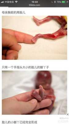 怀孕19周胎儿(怀孕19周胎儿有多大) 第2张 怀孕19周胎儿(怀孕19周胎儿有多大) 第2张