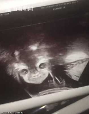 胎儿笑（婴儿望着天花板笑的是怎么回事呢?不知道是怎么了）  第3张
