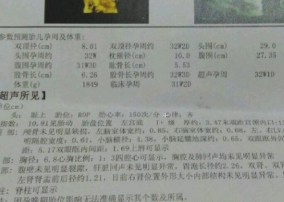 胎儿双顶径小(怀孕8个月多,检查双顶径有些小,孕晚期吃什么长胎儿双顶径) 第2张 胎儿双顶径小(怀孕8个月多,检查双顶径有些小,孕晚期吃什么长胎儿双顶径) 第2张