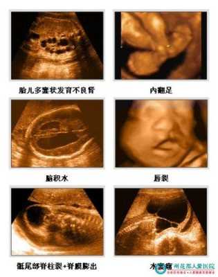 胎儿系统彩超（胎儿系统彩色多普勒超声检查是什么意思）  第2张