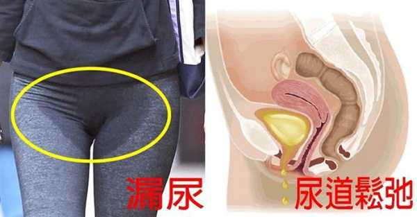 胎儿会尿尿吗(生孩子后会漏尿吗?) 第2张 胎儿会尿尿吗(生孩子后会漏尿吗?) 第2张