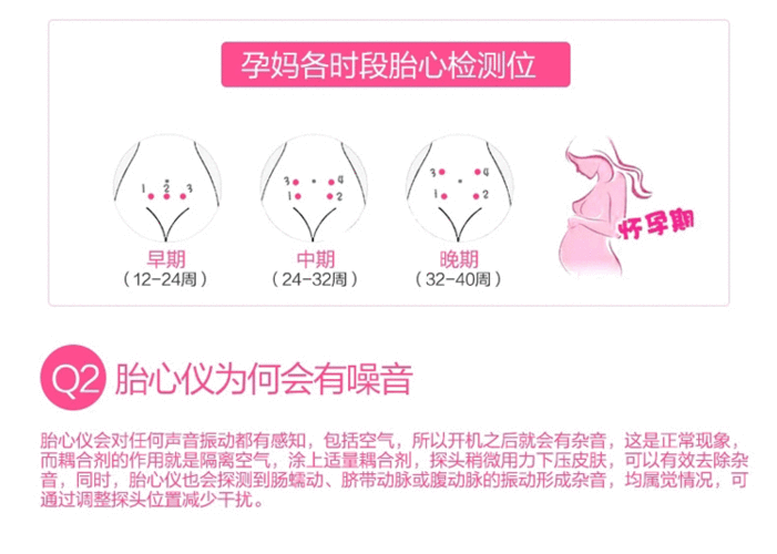 胎儿心率仪（胎儿心率仪怎么用）  第1张
