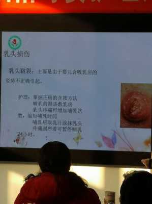 怀孕乳头变黑怎么办,孕期乳头发黑什么原因 第3张 怀孕乳头变黑怎么办,孕期乳头发黑什么原因 第3张