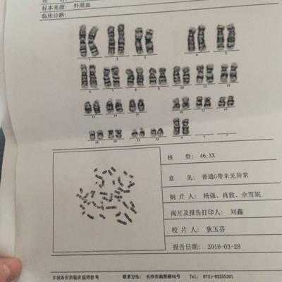 孕期染色体检查(胎儿染色体检查什么) 第2张 孕期染色体检查(胎儿染色体检查什么) 第2张