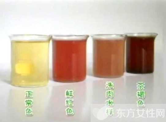 孕期尿黄正常吗(怀孕初期小便很黄怎么回事) 第2张 孕期尿黄正常吗(怀孕初期小便很黄怎么回事) 第2张