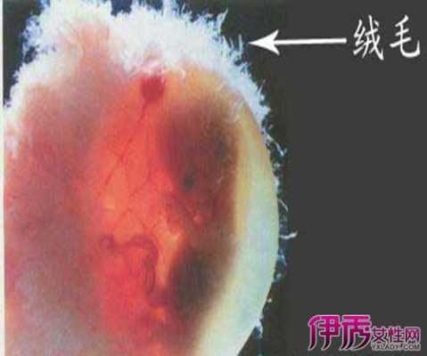 胎儿绒(胎儿绒毛是什么意思) 第1张 胎儿绒(胎儿绒毛是什么意思) 第1张