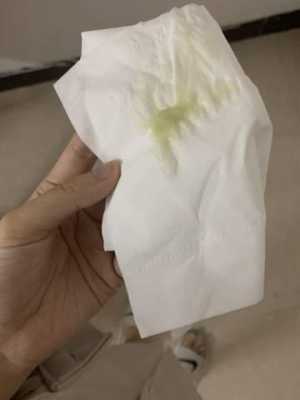 怀孕期间白带多(早期怀孕白带多吗?是怎么样子的症状) 第2张 怀孕期间白带多(早期怀孕白带多吗?是怎么样子的症状) 第2张