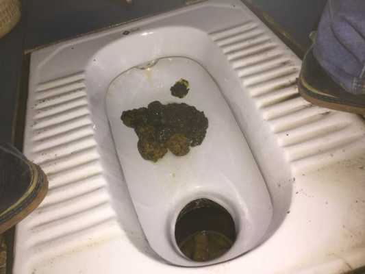 在备孕期间拉稀拉水了该怎么办,备孕期间拉肚子怎么办 第2张 在备孕期间拉稀拉水了该怎么办,备孕期间拉肚子怎么办 第2张