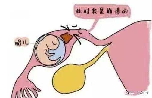 怀孕初期流褐色分泌物是怎么回事,怀孕期间分泌物褐色正常吗 第3张 怀孕初期流褐色分泌物是怎么回事,怀孕期间分泌物褐色正常吗 第3张