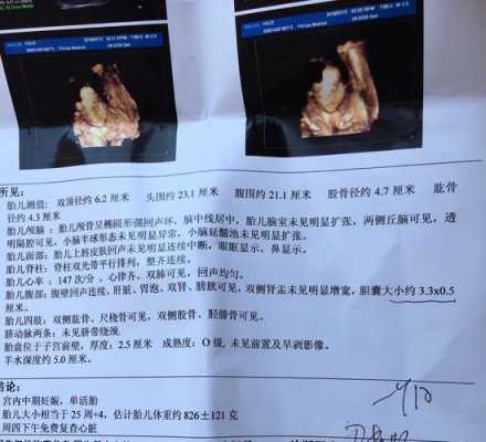 胎儿胆囊大(32周胎儿胆囊偏大38乘以11mm严重吗) 第2张 胎儿胆囊大(32周胎儿胆囊偏大38乘以11mm严重吗) 第2张