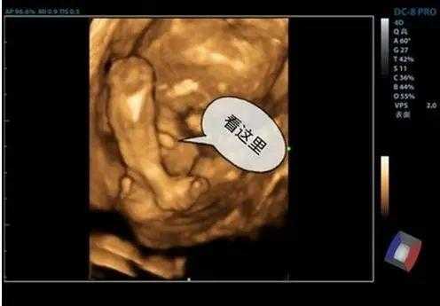 胎儿四维彩超图（四维彩超图片右上方的m和f什么意思）  第3张