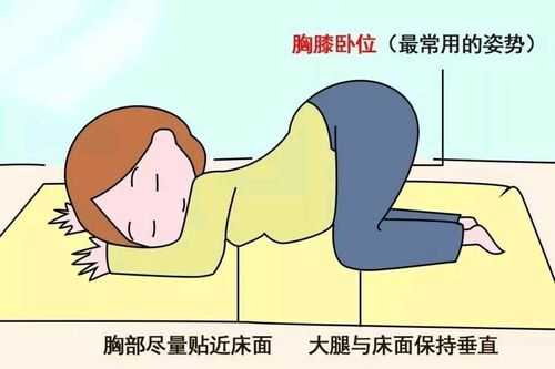 胎儿趴(孕妇趴着调整胎位该怎么做好) 第2张 胎儿趴(孕妇趴着调整胎位该怎么做好) 第2张
