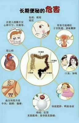 孕期便秘的原因(孕期便秘的原因有哪些) 第2张 孕期便秘的原因(孕期便秘的原因有哪些) 第2张