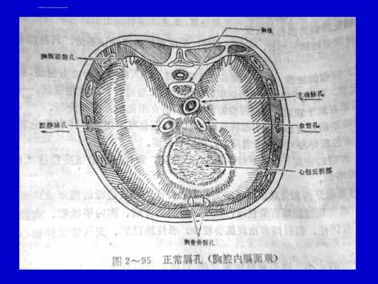 左侧膈疝?膈疝是什么病,胎儿隔疝怎么造成的 第3张 左侧膈疝?膈疝是什么病,胎儿隔疝怎么造成的 第3张
