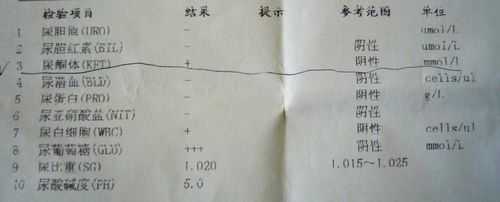 孕妇尿液检查酮体高是怎么回事,孕期尿酮体高说明什么问题呢 第1张 孕妇尿液检查酮体高是怎么回事,孕期尿酮体高说明什么问题呢 第1张