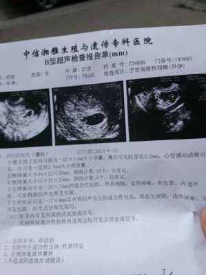 孕期卵巢囊肿怎么办,怀孕期间卵巢囊肿会变大吗  第2张