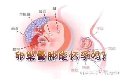 孕期卵巢囊肿怎么办,怀孕期间卵巢囊肿会变大吗  第1张