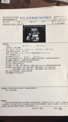 胎儿胆囊大小(提示胎儿胆囊显示不清,这说明什么情况) 第2张 胎儿胆囊大小(提示胎儿胆囊显示不清,这说明什么情况) 第2张