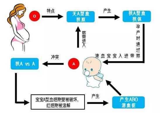 胎儿溶血症(胎儿溶血症是什么意思) 第2张 胎儿溶血症(胎儿溶血症是什么意思) 第2张