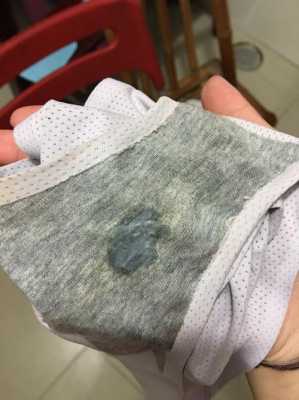 孕期白带拉丝(受精卵着床后会出现白带拉丝吗) 第2张 孕期白带拉丝(受精卵着床后会出现白带拉丝吗) 第2张