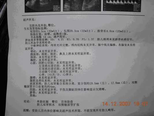 胎儿肾积水怎么办(怀孕胎儿肾积水怎么办) 第2张 胎儿肾积水怎么办(怀孕胎儿肾积水怎么办) 第2张