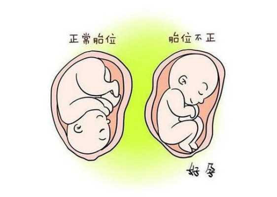 葡萄胎儿(兔子摸胎具体摸哪个位置) 第2张 葡萄胎儿(兔子摸胎具体摸哪个位置) 第2张