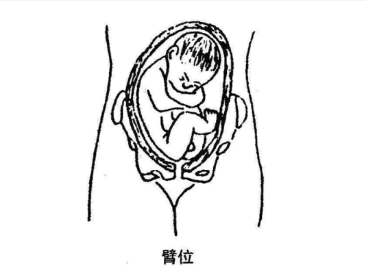 胎儿撅屁股(胎儿撅屁股蹬腿图片) 第2张 胎儿撅屁股(胎儿撅屁股蹬腿图片) 第2张