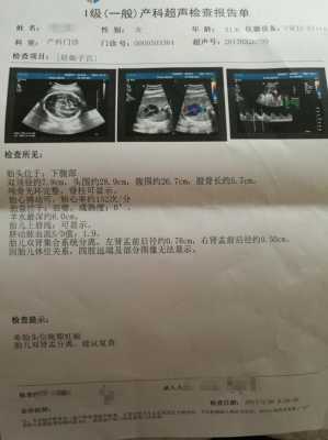 胎儿集合系统分离(四维彩超显示我胎儿左肾集合系统分离7mm,要紧吗) 第2张 胎儿集合系统分离(四维彩超显示我胎儿左肾集合系统分离7mm,要紧吗) 第2张