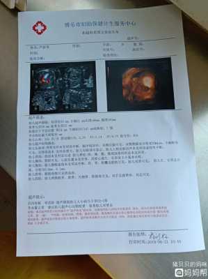 胎儿集合系统分离(四维彩超显示我胎儿左肾集合系统分离7mm,要紧吗) 第1张 胎儿集合系统分离(四维彩超显示我胎儿左肾集合系统分离7mm,要紧吗) 第1张