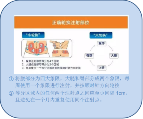 孕期胰岛素怎么打(孕期打胰岛素可以吗) 第2张 孕期胰岛素怎么打(孕期打胰岛素可以吗) 第2张