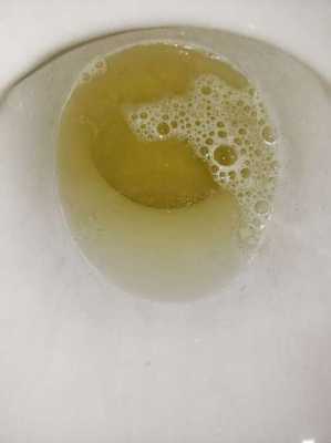 孕期尿液混浊(小便混浊是怎么了) 第2张 孕期尿液混浊(小便混浊是怎么了) 第2张