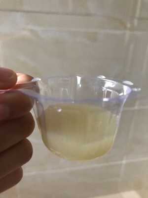 孕期尿液混浊(小便混浊是怎么了) 第1张 孕期尿液混浊(小便混浊是怎么了) 第1张