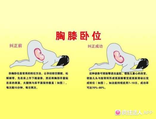 胎儿臂位(胎儿臂位) 第2张 胎儿臂位(胎儿臂位) 第2张