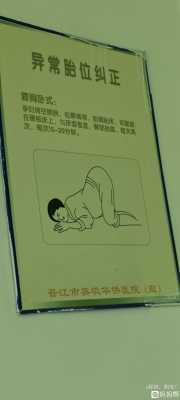 什么原因导致胎儿横位怎么纠正,快生了胎儿横位怎么办 第3张 什么原因导致胎儿横位怎么纠正,快生了胎儿横位怎么办 第3张