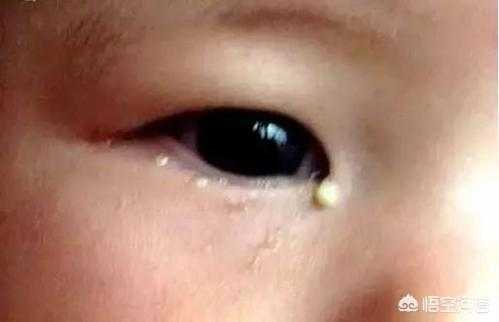 6个月胎儿图片(宝宝6个月了,眼睛还是有很多眼屎,怎么回事) 第3张 6个月胎儿图片(宝宝6个月了,眼睛还是有很多眼屎,怎么回事) 第3张