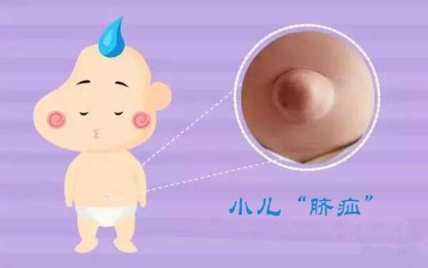 脐疝对宝宝有什么影响吗,胎儿脐疝属于畸形吗 第1张 脐疝对宝宝有什么影响吗,胎儿脐疝属于畸形吗 第1张