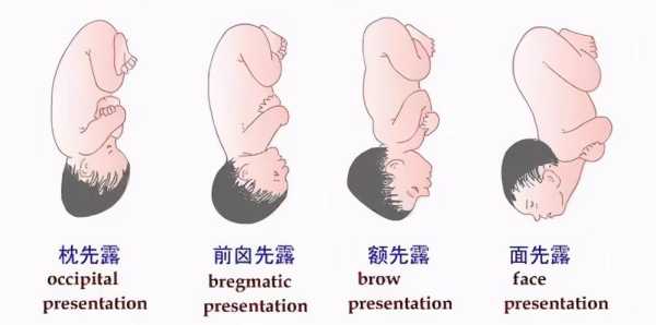 loa是什么的简写,胎儿loa是什么胎位  第2张