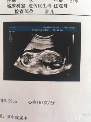 18周胎儿多大(怀孕18周胎动的感觉是怎样的) 第1张 18周胎儿多大(怀孕18周胎动的感觉是怎样的) 第1张